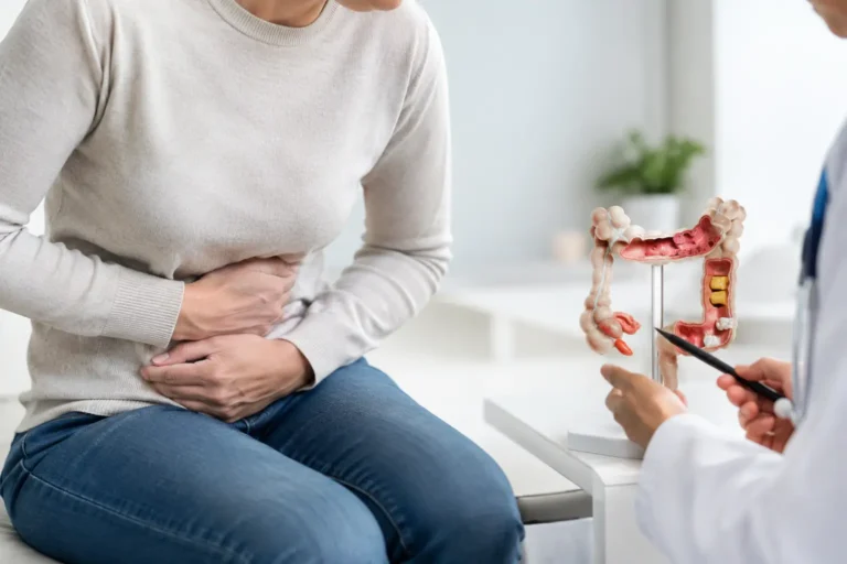 Cuándo operar la diverticulitis recurrente