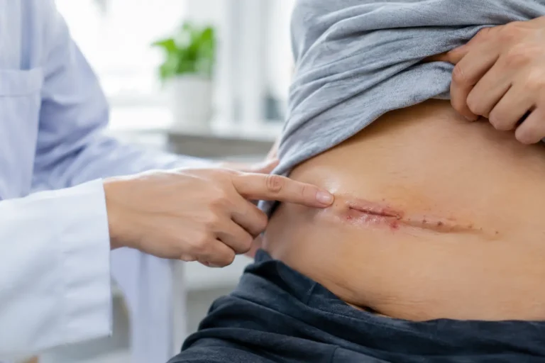 Señales de infección postoperatoria que requieren revisión